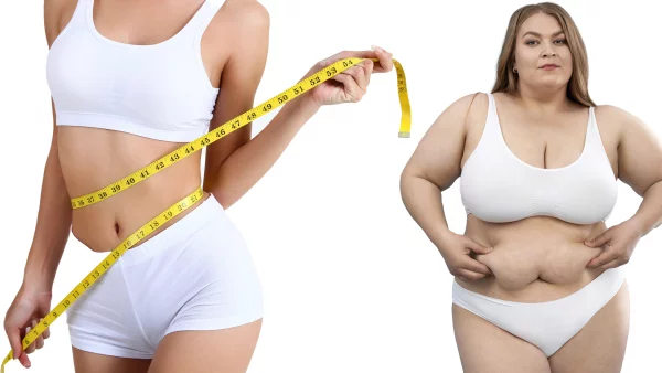 Bariatrik Cerrahi ve Psikodiyet